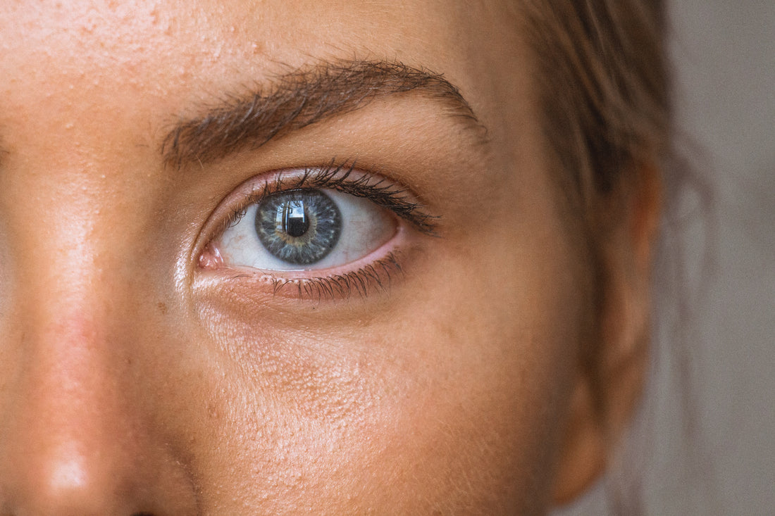 Magnesium Chloride for Skin Health, Acne, Eczema and Dermatitis